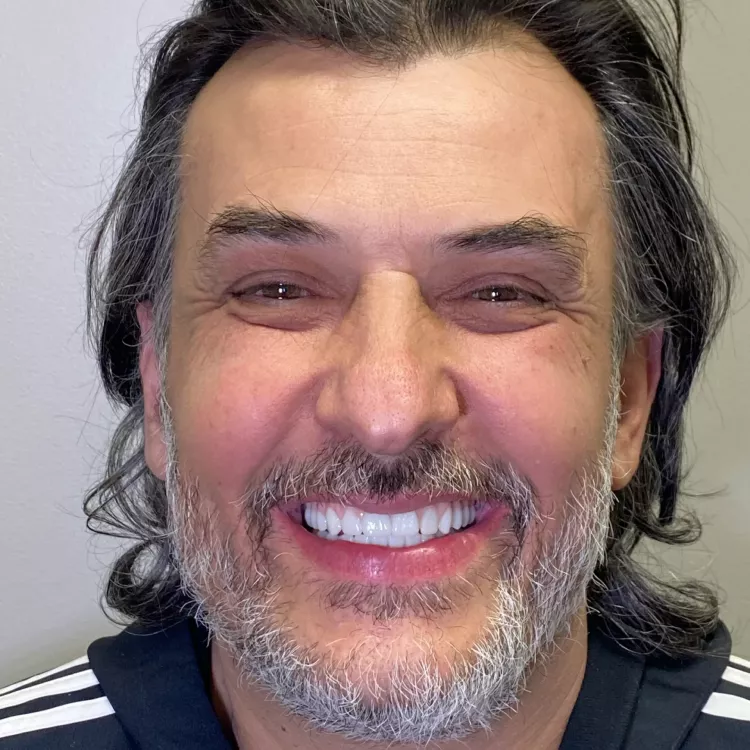 A patient's after image smiling.