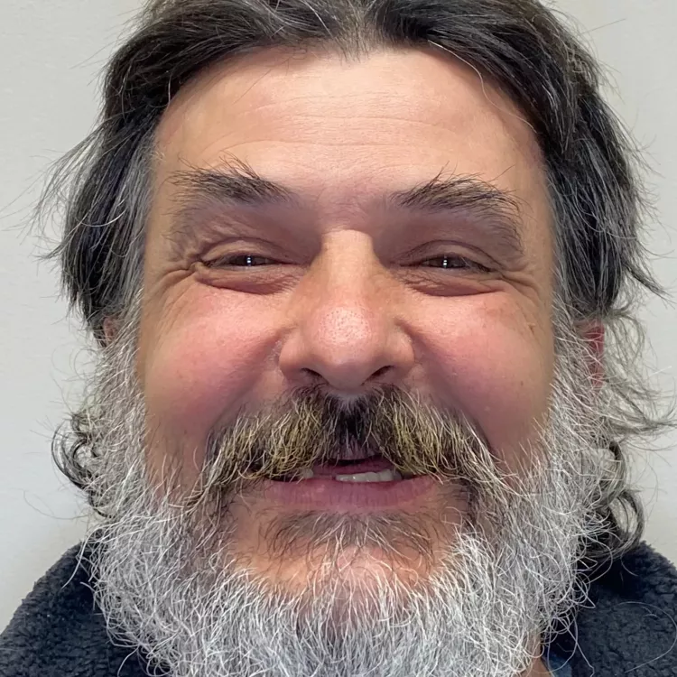 A patient's before image smiling.