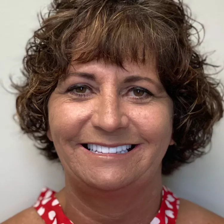 A patient's after image smiling.