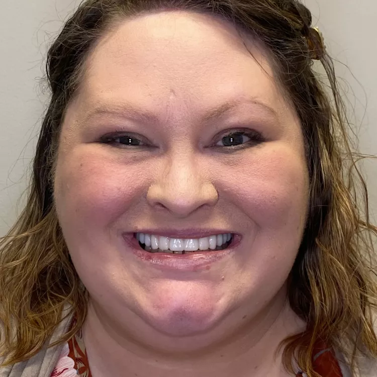 A patient's after image smiling.