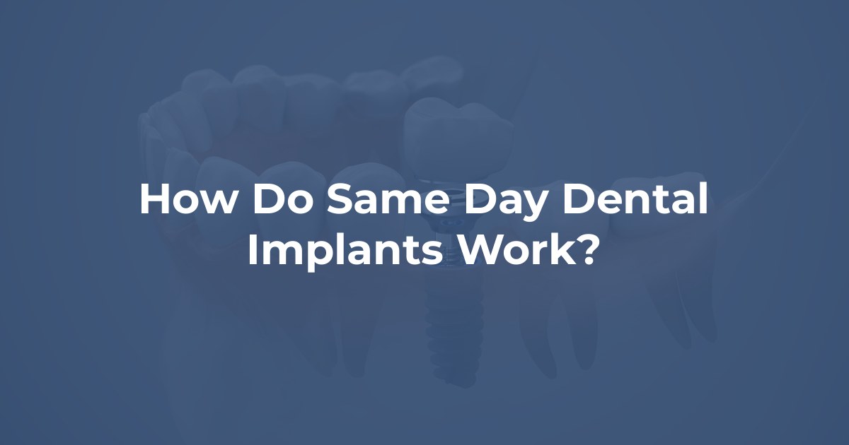 How Do Same Day Dental Implants Work? at Whitewater Oral Surgery Group